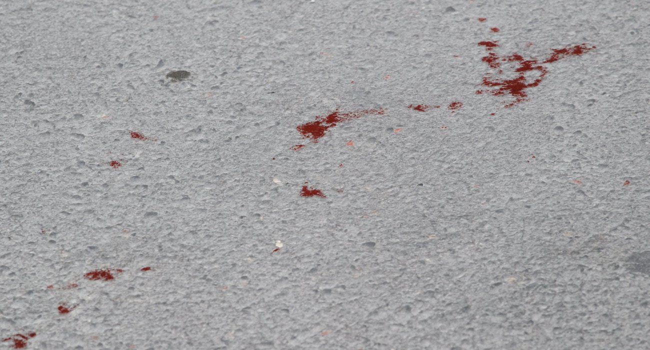 Χαλκίδα: Πήγαν τον 23χρονο με αγροτικό στο νοσοκομείο και τον παράτησαν απ' έξω