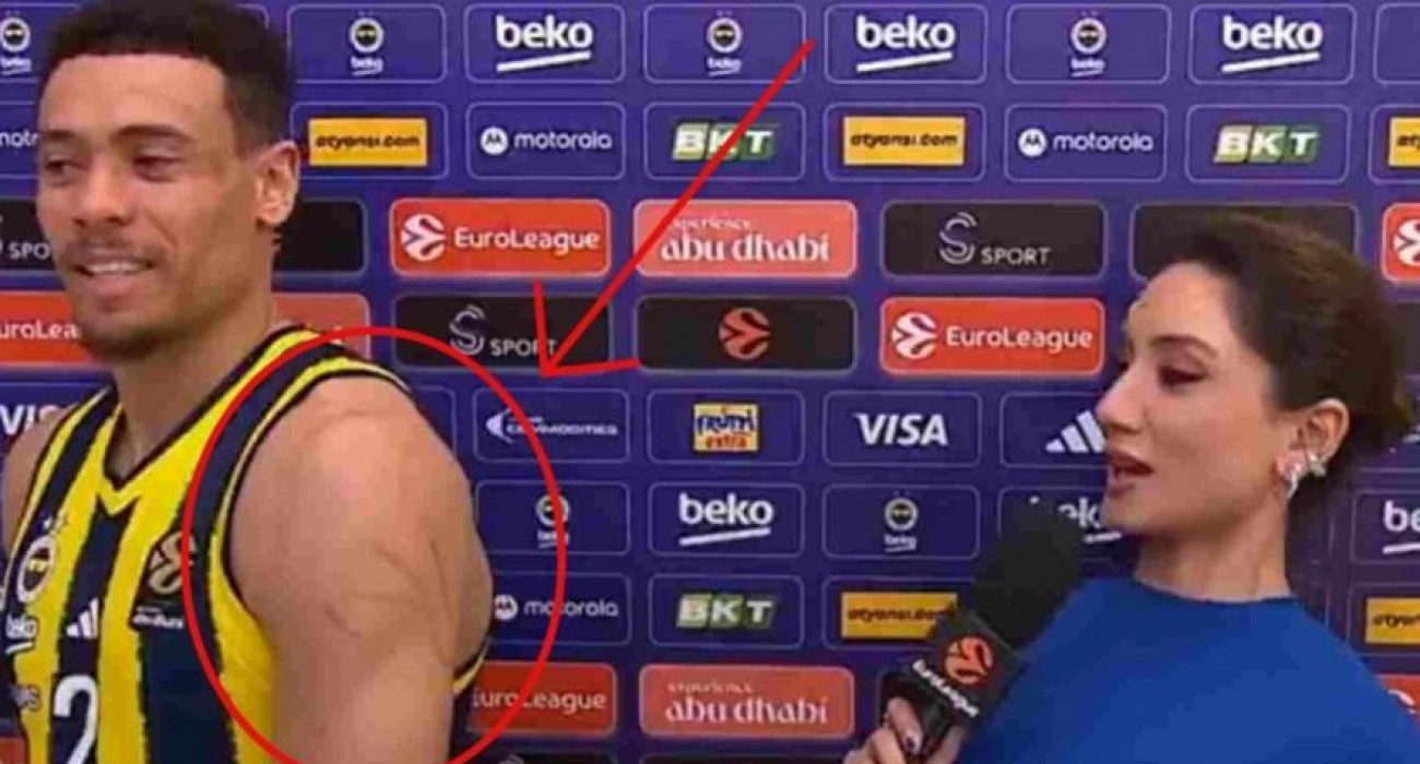 Αιχμές Μπόλντγουιν για τον Ολυμπιακό, έδειξε τις γρατζουνιές του on camera: «Αυτό είναι το παιχνίδι του...» (video)