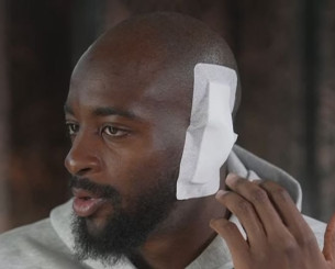 Σοκάρει ο Ματετά: «Το αυτί μου κρεμόταν, ο χειρουργός δεν μου το έδειξε»