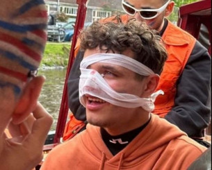 Ο σοκαριστικός τραυματισμός του Λάντο Νόρις - Ένας φωτογράφος παραλίγο να του σπάσει τη μύτη (video)