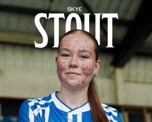 Η Κιλμάρνοκ ανακοίνωσε 16χρονη παίκτρια και μετά από αρνητικά σχόλια απέσυρε τη δημοσίευση