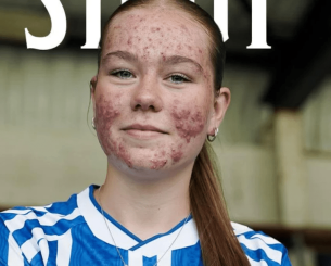 H 16χρονη Σκάι απάντησε στο bullying με γκολ στο ντεμπούτο της