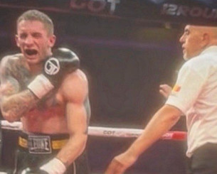 Απίστευτο σκηνικό: Αλβανός πυγμάχος δάγκωσε τον Σέρβο αντίπαλο του και τον κέρδισε! (photo)