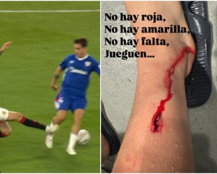 Σοκάρει η εικόνα που ανέβασε ο Πράντος της Μπιλμπάο μετά το μαρκάρισμα του Λίντελοφ - «Ούτε φάουλ, ούτε κάρτα»