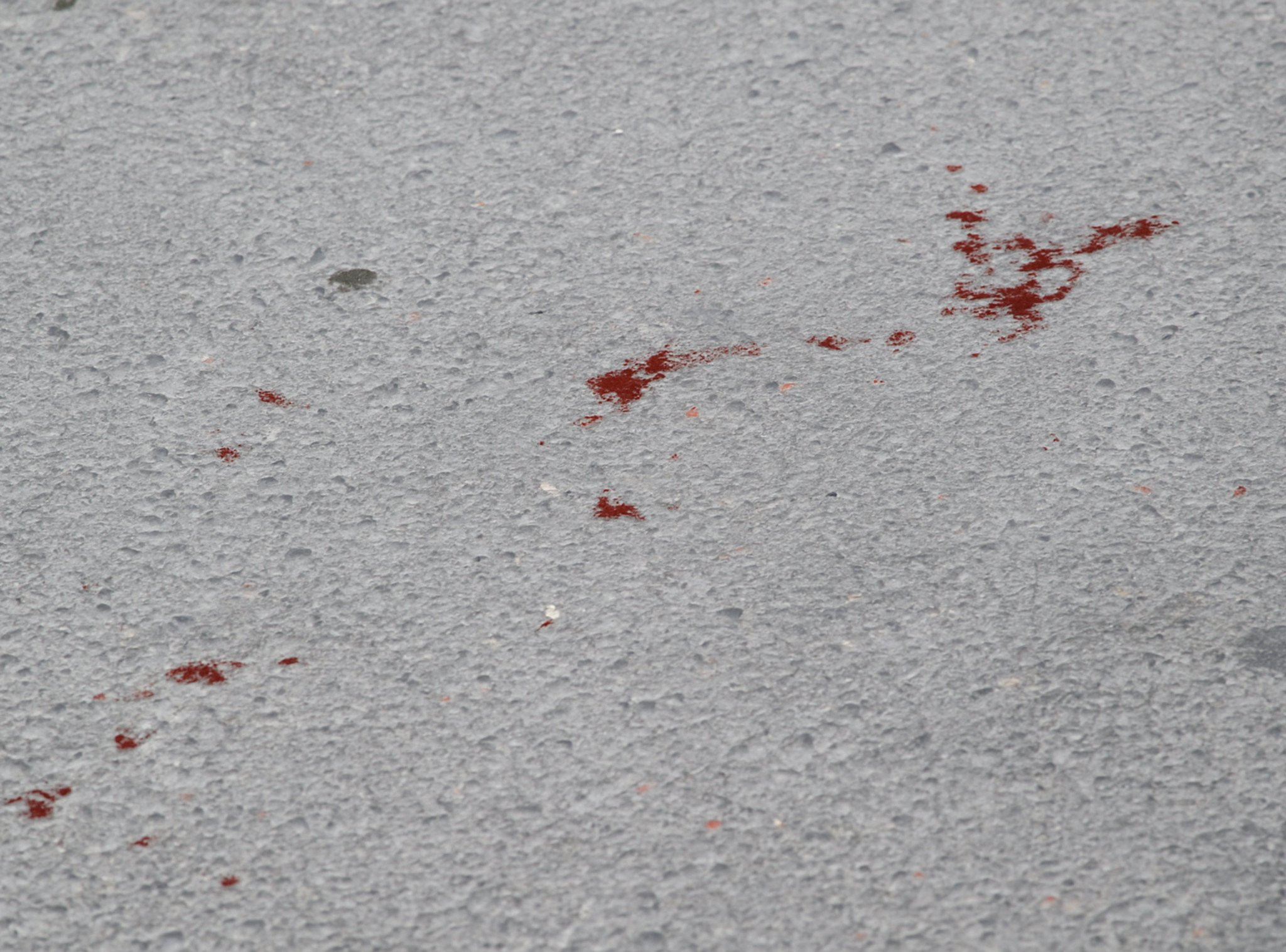 Χαλκίδα: Πήγαν τον 23χρονο με αγροτικό στο νοσοκομείο και τον παράτησαν απ' έξω