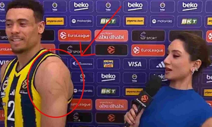 Αιχμές Μπόλντγουιν για τον Ολυμπιακό, έδειξε τις γρατζουνιές του on camera: «Αυτό είναι το παιχνίδι του...» (video)