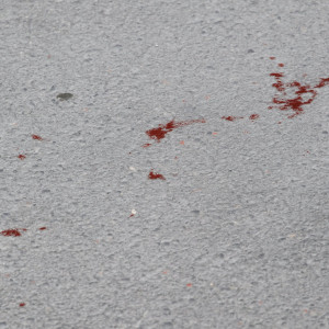 Χαλκίδα: Πήγαν τον 23χρονο με αγροτικό στο νοσοκομείο και τον παράτησαν απ' έξω