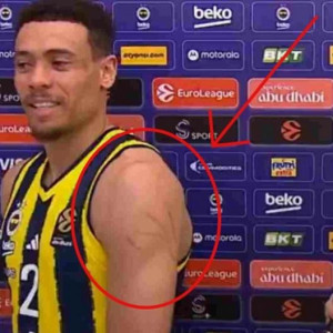 Αιχμές Μπόλντγουιν για τον Ολυμπιακό, έδειξε τις γρατζουνιές του on camera: «Αυτό είναι το παιχνίδι του...» (video)